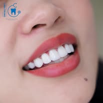 Nha Khoa Tổng Quát