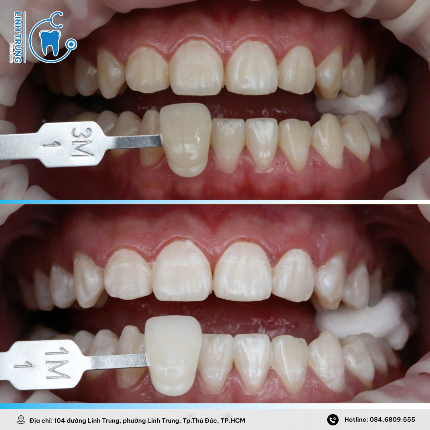 Nha Khoa Thẩm Mỹ